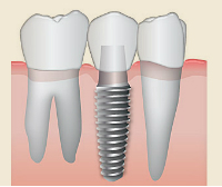 Expert Dental Care