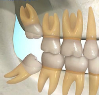 Expert Dental Care