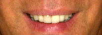 Expert Dental Care