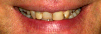 Expert Dental Care