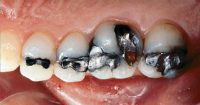 Expert Dental Care