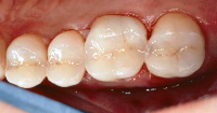 Expert Dental Care