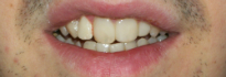 Expert Dental Care