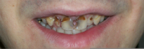 Expert Dental Care