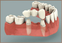 Expert Dental Care